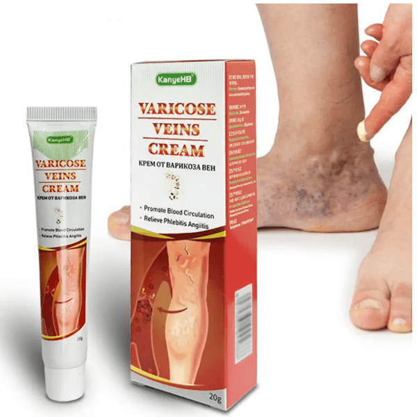 Kanyehb Varicose Veins Cream — KanyeHB — in Pakistan (image 2)