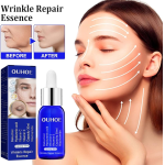 Ouhoe Wrinkles Repair Essence Face Serum
