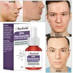 Beafadel Plant 20% Niacinamide Face Serum