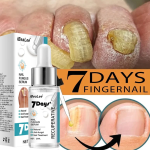 IBeaLee Nail Fungus Serum