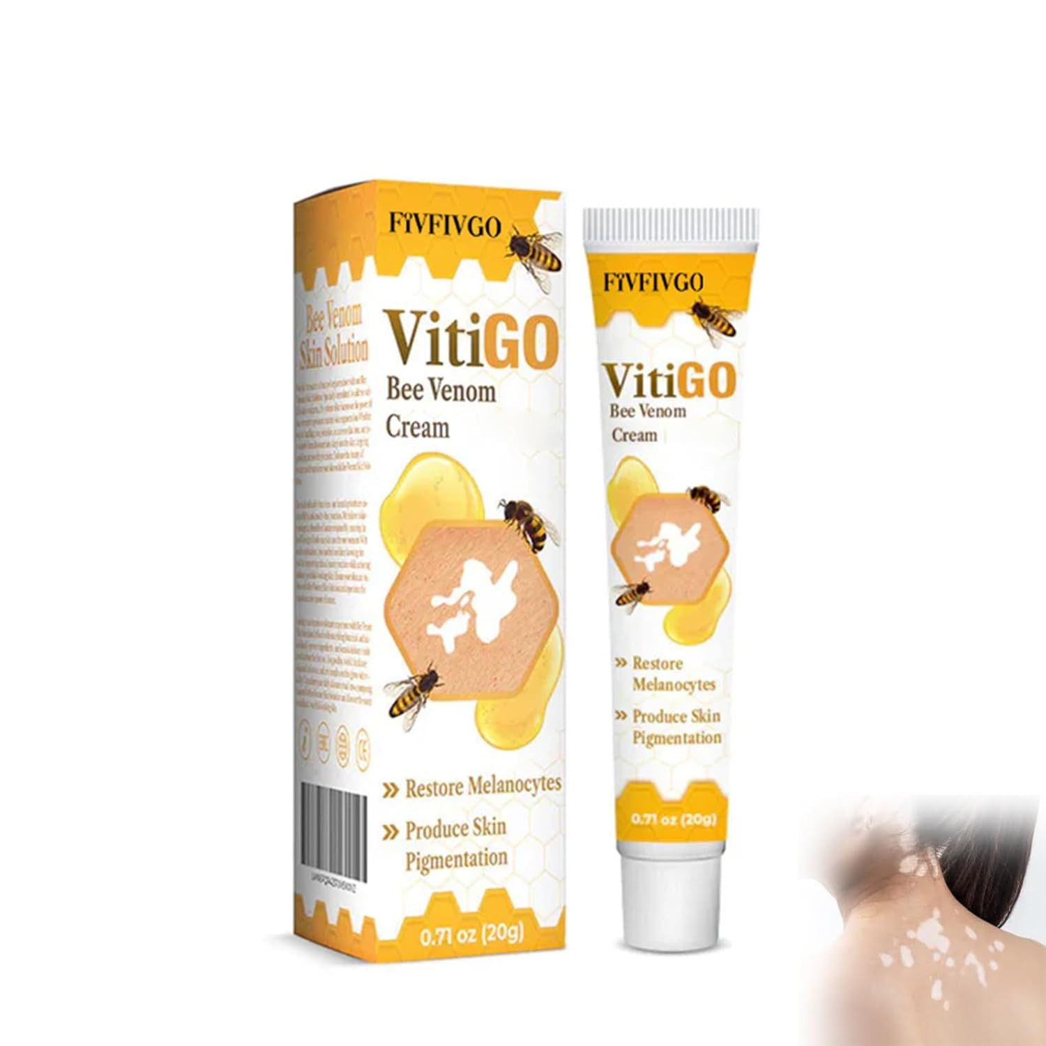 Bee Venom Vitiligo Treatment Cream