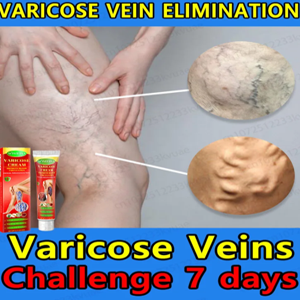 Aomfisa Varicose Veins Cream