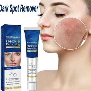 Nicotinamide Freckle Removing Cream