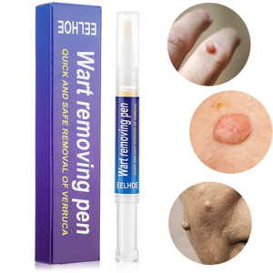 Eelhoe Wart Removing Pen