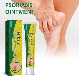 Ximonth Herbal Psoriasis Ointment