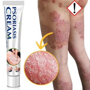 yifuooo Psoriasis Removal Cream