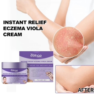 Eelhoe Instant Relief Eczema Viola Cream