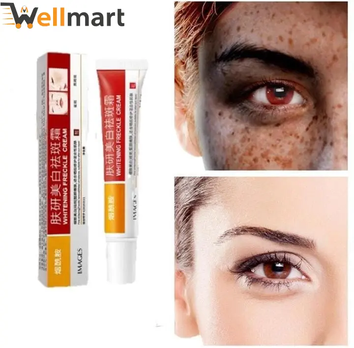 YRFKT Face Brightening Freckles Cream