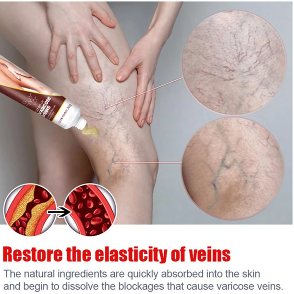 KanyeHB Vein Cream