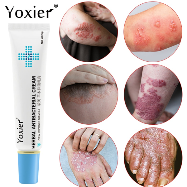 Yoxier Herbal Antibacterial Cream