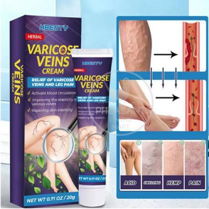 Hbesty Varicose Vein Cream