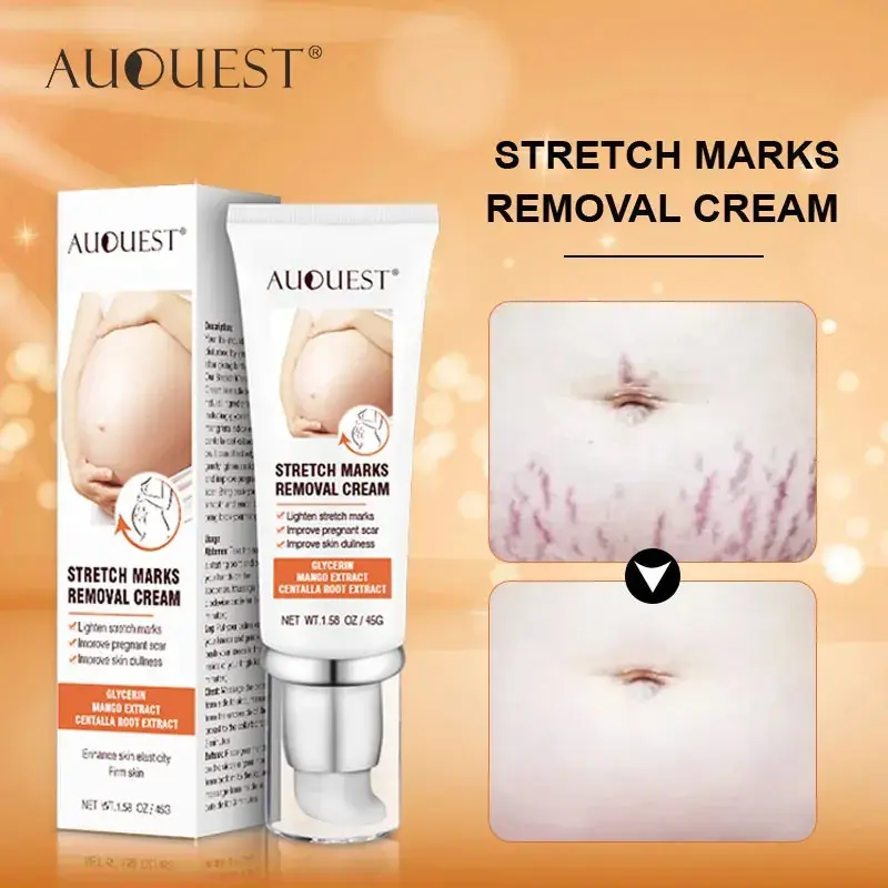 Auquest Stretch Marks Cream