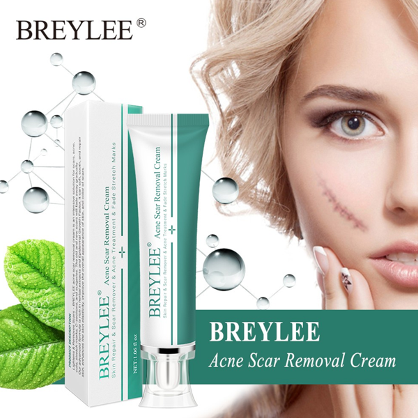 Breylee Acne Scar Removal Cream