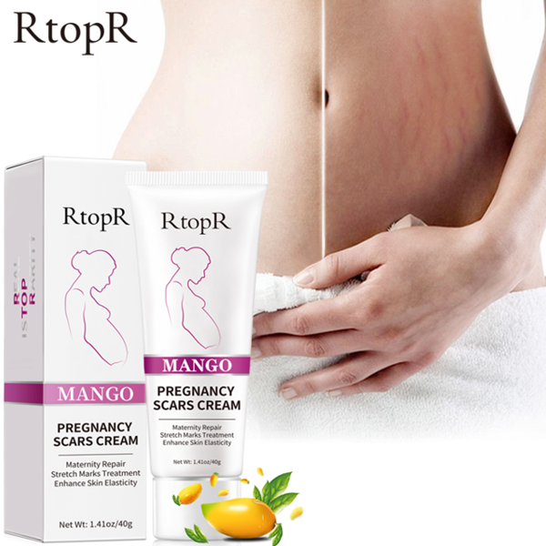 Rtopr Mango Remove Pregnancy Scars Cream