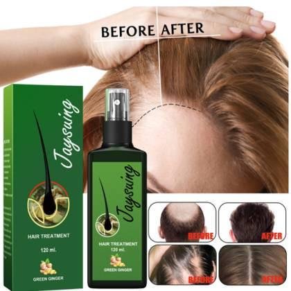 Jaysuing Hair Growth Spray