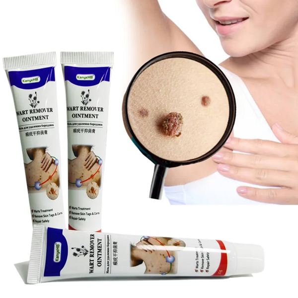 Kanyehb Wart Remover Ointment Cream