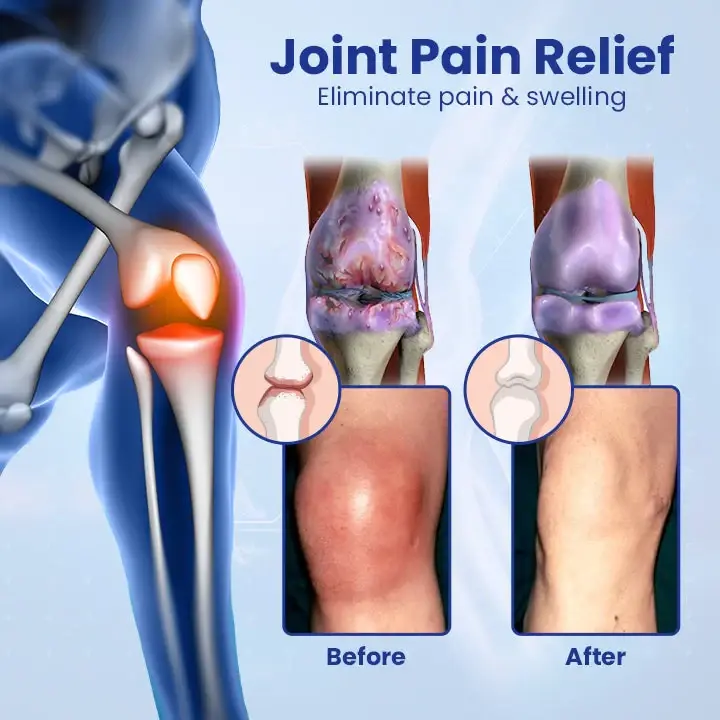 Ximonth Joint Renew Bone Repair Gel Roller