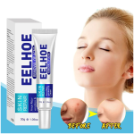 Eelhoe Acne Removal Cream