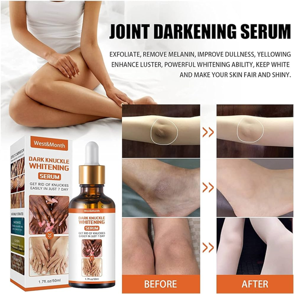 West&month Dark Knuckles Whitening Serum