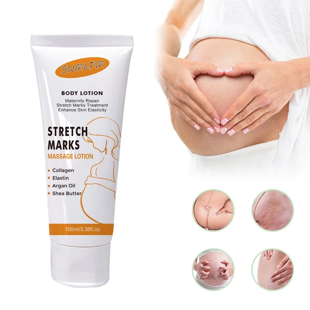 Snmlpm Stretch Mark Massage Lotion