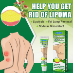 Sumifun Lipoma Treatment Cream