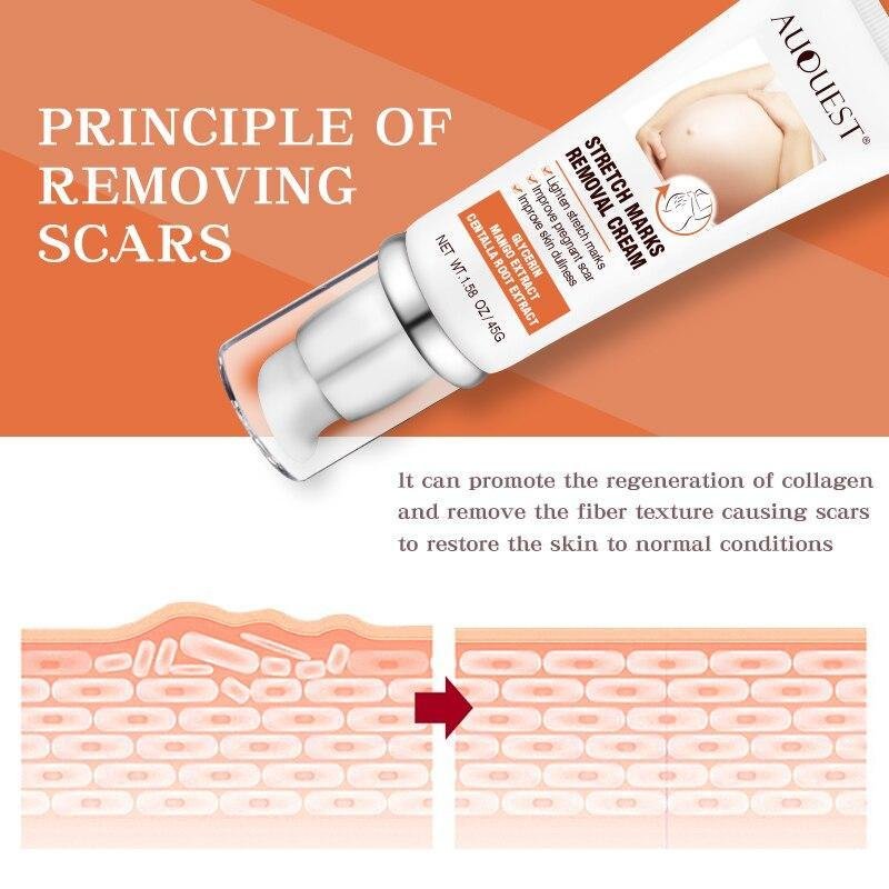 Auquest Stretch Marks Cream