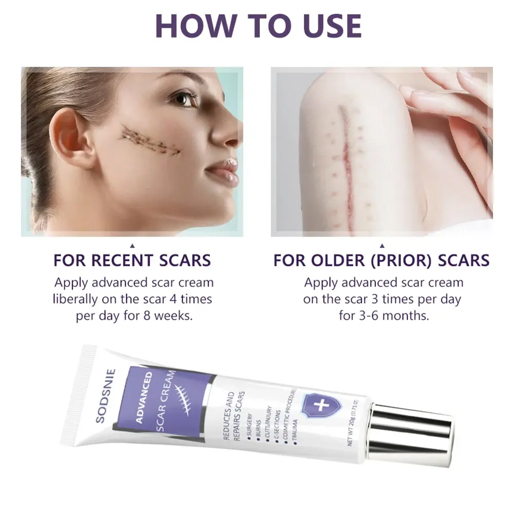 Sodsnie Advanced Scar Cream