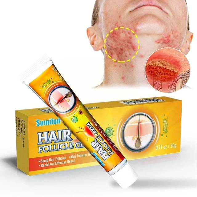 Sumifun Hair Follicle Treat Cream