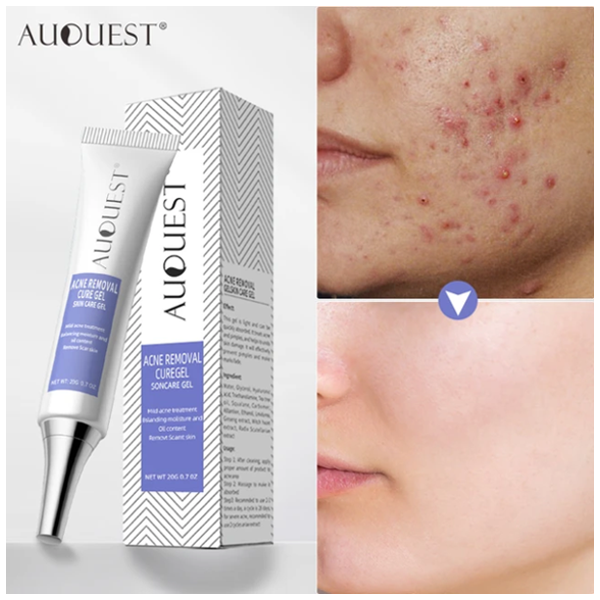Auquest Acne Removal Cure Gel